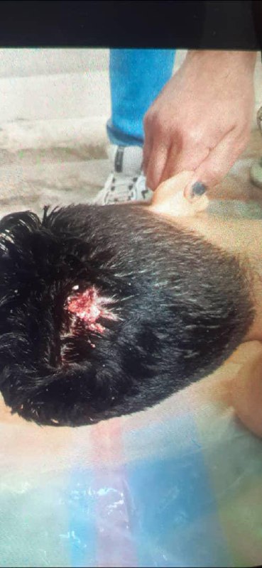 ⚠️ پیکر بی‌جان یک جوان ۱۸ سالهتصاویر دریافتی با شرح