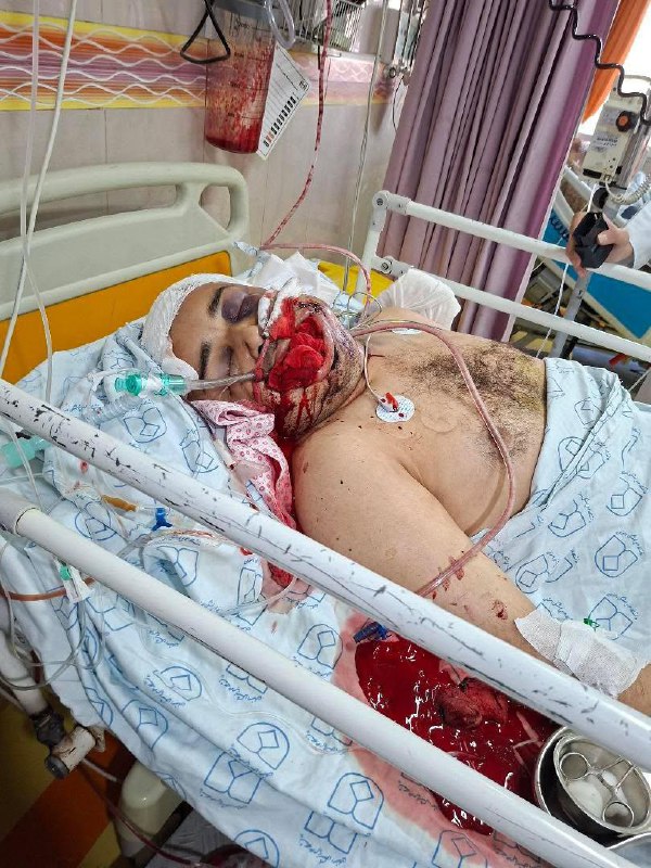 ⚠️تصاویر دلخراش و خونین دریافتی از بیمارستانی در #اصفهانتوییت انگلیسی برای ریتوییت