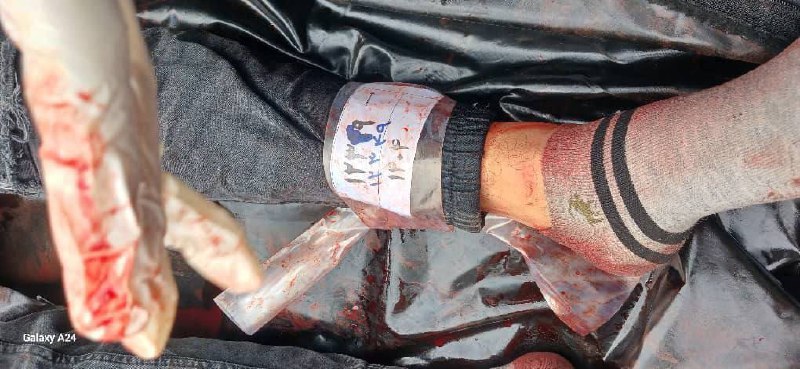 ⚠️ پیکر بی‌جان جوان ۲۲ سالهتصاویر دریافتی با شرح