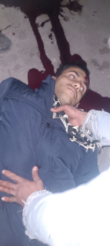 ⚠️ پیکر بی‌جان و خونینتصاویر دریافتی با شرح