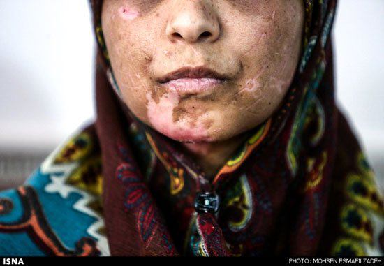 دادگاه شوهر اعظم را به  ۱۵ سال و ۶ ماه حبس محکوم کرد.شوهرش با زندانی کردن اعظم داخل صندوق فلزی و آتش روشن کردن زیرآن قصد کشتن اعظم را داشتShabnamRahmati