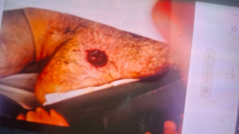 ⚠️ پیکر بی‌جان با جای گلوله روی سینهتصاویر دریافتی با شرح