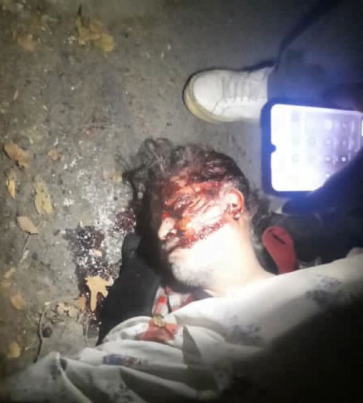 ⚠️ پیکر بی‌جان با سر خونینتصاویر دریافتی با شرح