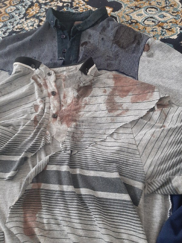 ⚠️ پیکر بی‌جانتصاویر دریافتی با شرح