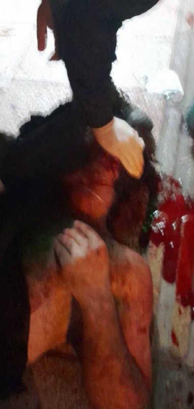 ⚠️تصاویر دریافتی از 'پیکر خونین #احمدرضا_قادری، اهل #بابل که در اعتراض‌های #ساری کشته شد. پنجشنبه ۱۸ دی'Vahid📡 @VahidOnline⚠️تصاویر دریافتی از 'پیکر خونین #احمدرضا_قادری، اهل #بابل که در اعتراض‌های #ساری کشته شد. پنجشنبه ۱۸ دی'Vahid📡 @VahidOnline