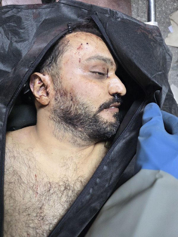 ⚠️ پیکر بی‌جانتصاویر دریافتی با شرح