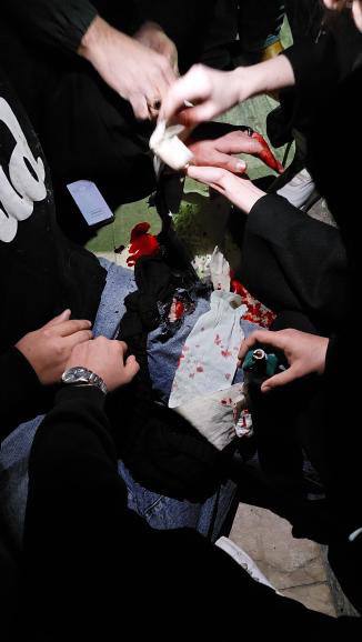 ⚠️تصاویر خونین از زخمی‌ها در یک پارکینگ