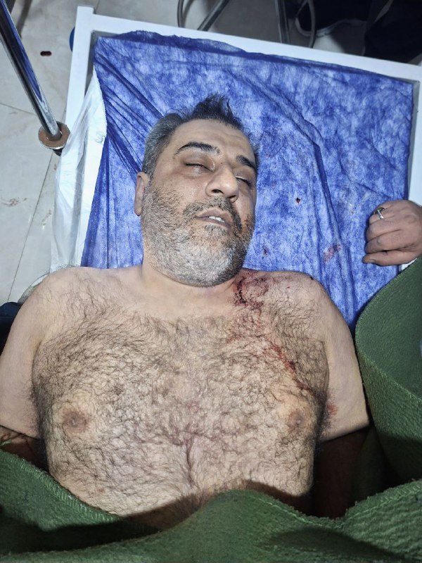 ⚠️پیکر بی‌جانتصاویر دریافتی با شرح