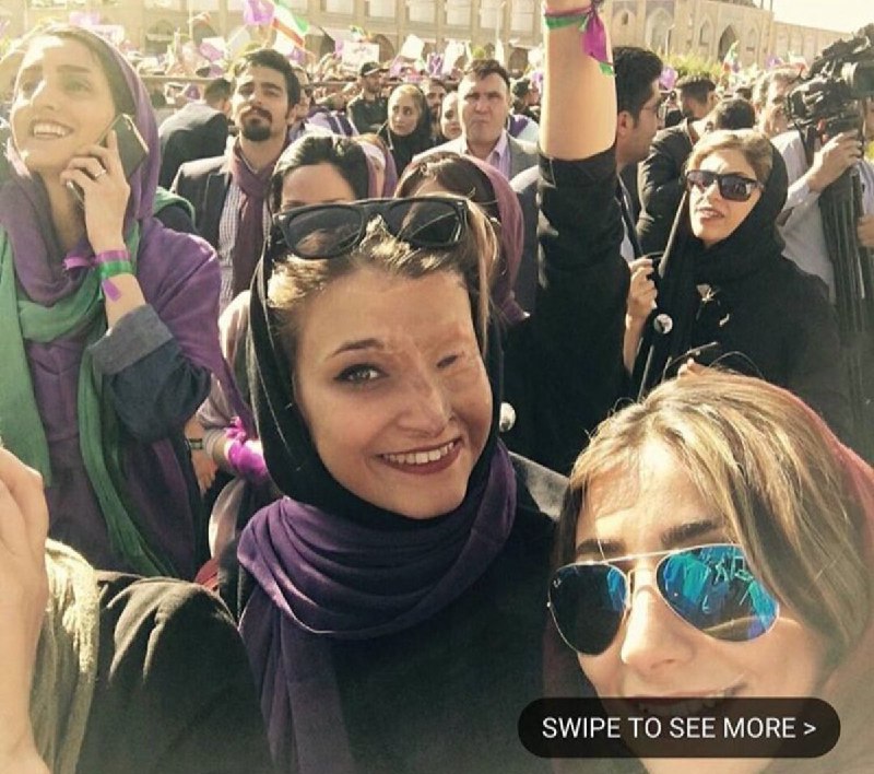 #مرضیه_ابراهیمی قربانی #اسیدپاشی سال٩٣shiiva8