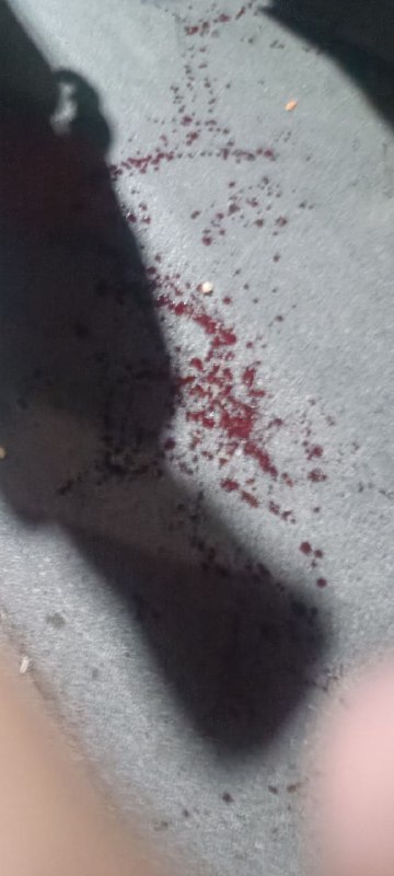 ⚠️ پیکر بی‌جان و خونینتصاویر دریافتی با شرح