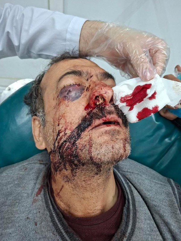 ⚠️تصاویر دلخراش و خونین دریافتی از بیمارستانی در #اصفهانتوییت انگلیسی برای ریتوییت