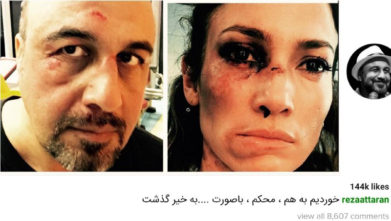شوخی اینستاگرامی رضا #عطاران با #جنیفرلوپزbalabeik