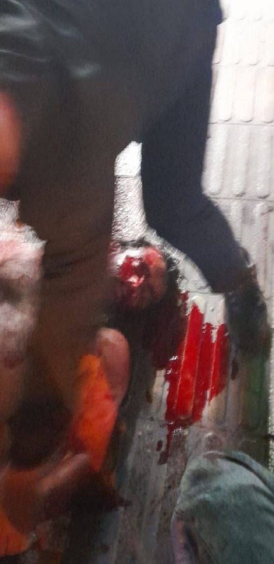 ⚠️تصاویر دریافتی از 'پیکر خونین #احمدرضا_قادری، اهل #بابل که در اعتراض‌های #ساری کشته شد. پنجشنبه ۱۸ دی'Vahid📡 @VahidOnline⚠️تصاویر دریافتی از 'پیکر خونین #احمدرضا_قادری، اهل #بابل که در اعتراض‌های #ساری کشته شد. پنجشنبه ۱۸ دی'Vahid📡 @VahidOnline