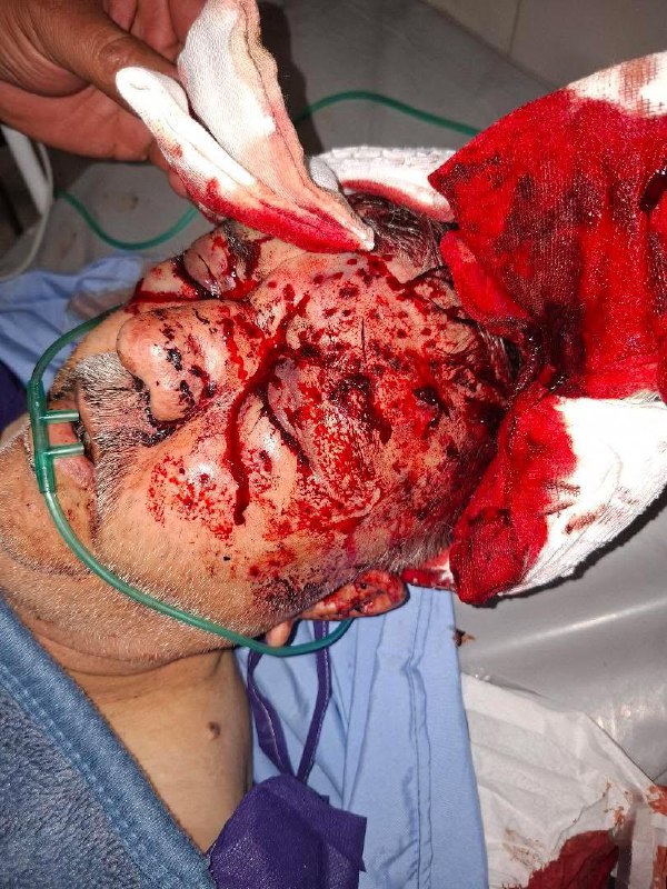 ⚠️تصاویر دلخراش و خونین دریافتی از بیمارستانی در #اصفهانتوییت انگلیسی برای ریتوییت