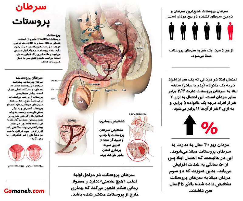 از هر ۶ مرد ۱ مرد به #سرطان #پروستات مبتلا می‌شود. اینفوگرافیکی در این مورد به مناسبت #movember0sefr