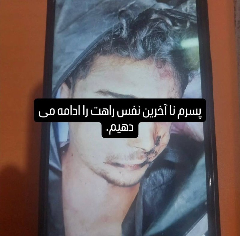 ⚠️چهره بی‌جان جوان ۱۸ سالهتصاویر دریافتی با شرح