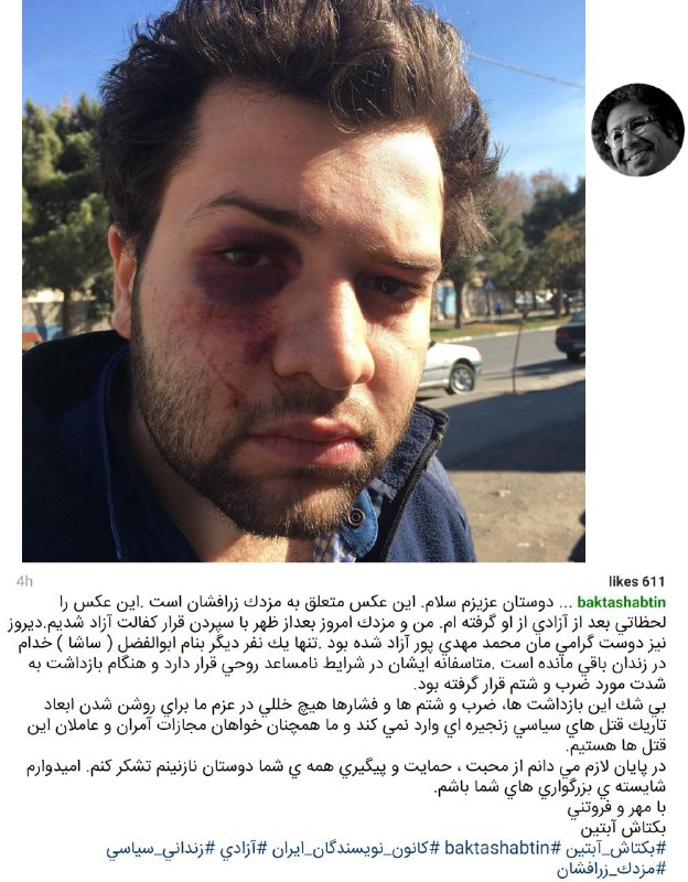#بکتاش_آبتین عضو #کانون_نویسندگان ایران بعد از آزادی این عکس رو از اثرات ضرب و شتم #مزدک_زرافشان در اینستاگرام منتشر کردهEmaadb