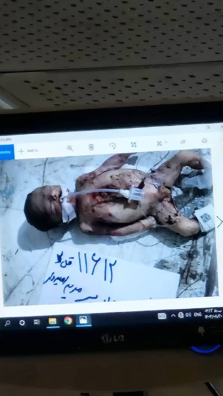 ⚠️ #نوزاد ولی بی‌جانویدیوی آخر