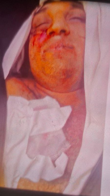 ⚠️ پیکر بی‌جان با جای گلوله روی سینهتصاویر دریافتی با شرح