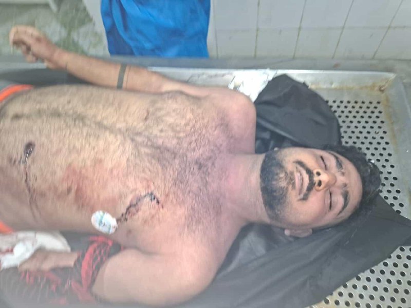 ⚠️  پیکر بی‌جان و گلوله خورده جوان ۱۹ سالهتصاویر دریافتی با شرح