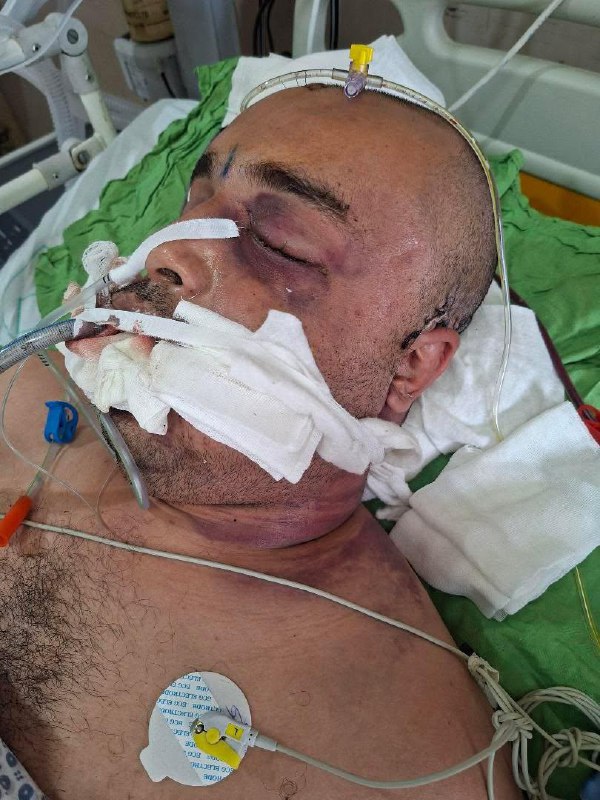 ⚠️تصاویر دلخراش و خونین دریافتی از بیمارستانی در #اصفهانتوییت انگلیسی برای ریتوییت