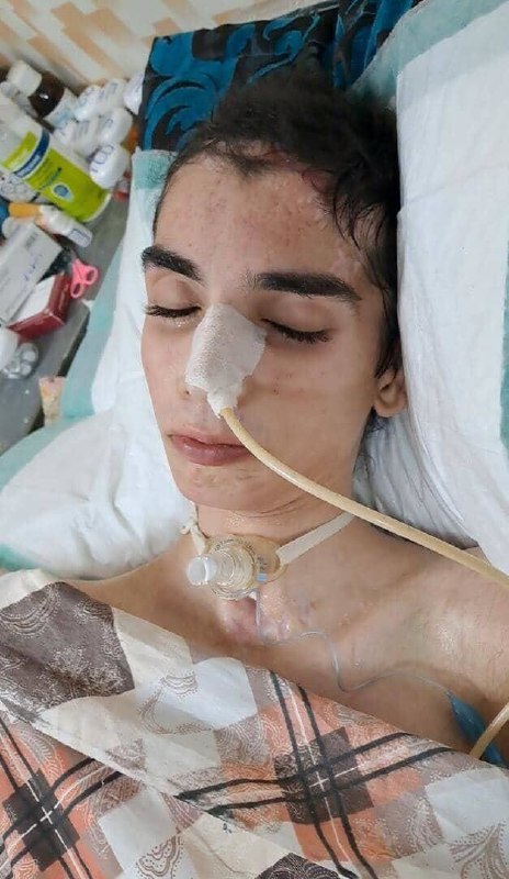 ابوالفضل امیرعطایی فقط ۱۶ سال دارد. در ۳۰ شهریور ۱۴۰۱ در شهرری یک نیروی حکومتی گاز اشک‌آور را از روبه‌رو از فاصله یک متری به سر ابوالفضل شلیک می‌کند.جمجمه سمت چپ کامل ترکیده و یک سری رگ‌های عصبی‌اش تخلیه شده. او در حال حاضر فلج است و فقط چشمانش حرکت می‌کند.این بچه نیاز به یک جراح مغز دارد. کمک کنیم ابوالفضل ۱۶ ساله دوباره حرکت کند. via SalomeSeyednia#ابوالفضل_امیرعطایی📡 @VahidOnlineابوالفضل امیرعطایی فقط ۱۶ سال دارد. در ۳۰ شهریور ۱۴۰۱ در شهرری یک نیروی حکومتی گاز اشک‌آور را از روبه‌رو از فاصله یک متری به سر ابوالفضل شلیک می‌کند.جمجمه سمت چپ کامل ترکیده و یک سری رگ‌های عصبی‌اش تخلیه شده. او در حال حاضر فلج است و فقط چشمانش حرکت می‌کند.این بچه نیاز به یک جراح مغز دارد. کمک کنیم ابوالفضل ۱۶ ساله دوباره حرکت کند. via SalomeSeyednia#ابوالفضل_امیرعطایی📡 @VahidOnline