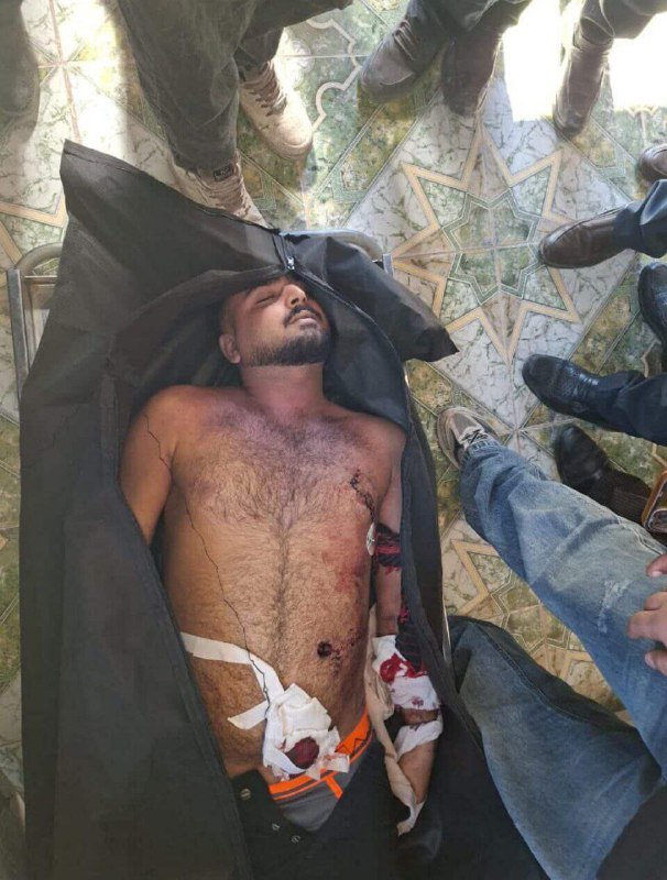 ⚠️  پیکر بی‌جان و گلوله خورده جوان ۱۹ سالهتصاویر دریافتی با شرح