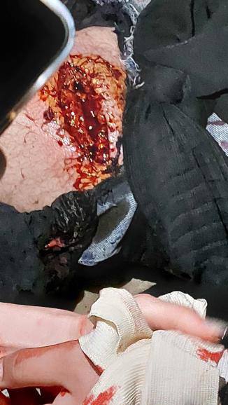 ⚠️تصاویر خونین از زخمی‌ها در یک پارکینگ