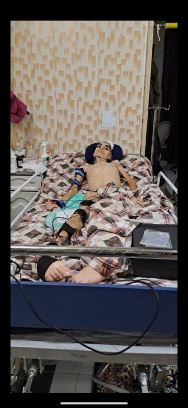 ابوالفضل امیرعطایی، نوجوان ۱۶ ساله‌ای که در اعتراضات ۳۰ شهریور در شهر ری از ناحیه سر زخمی شده بود، پنجم خرداد بعد از هشت ماه تحمل درد در بیمارستان جان باخت.#‌ابوالفضل_امیرعطایی، شب سی‌ام شهریور در میدان نماز شهر ری از فاصله‌ای نزدیک هدف گاز اشک‌آور قرار گرفت و نیمی از جمجمه خود را از دست داد.او طی هشت ماه گذشته چندین جراحی سنگین را پشت سر گذاشته بود. در آخرین ویدئویی که مادرش در اینستاگرام شخصی‌اش از او منتشر کرده بود بعد از هشت ماه او می‌توانست چشمانش را حرکت دهد و انگشت‌های دست‌هایش را تکان دهد.نزدیکان خانواده امیرعطایی گفته‌اند که در بیمارستان هفتم تیر از خانواده او تعهد گرفته‌ بودند که از سپاه، بسیج و نیروی انتظامی شکایت نکنند.@VahidHeadline📡 @VahidOnlineابوالفضل امیرعطایی، نوجوان ۱۶ ساله‌ای که در اعتراضات ۳۰ شهریور در شهر ری از ناحیه سر زخمی شده بود، پنجم خرداد بعد از هشت ماه تحمل درد در بیمارستان جان باخت.#‌ابوالفضل_امیرعطایی، شب سی‌ام شهریور در میدان نماز شهر ری از فاصله‌ای نزدیک هدف گاز اشک‌آور قرار گرفت و نیمی از جمجمه خود را از دست داد.او طی هشت ماه گذشته چندین جراحی سنگین را پشت سر گذاشته بود. در آخرین ویدئویی که مادرش در اینستاگرام شخصی‌اش از او منتشر کرده بود بعد از هشت ماه او می‌توانست چشمانش را حرکت دهد و انگشت‌های دست‌هایش را تکان دهد.نزدیکان خانواده امیرعطایی گفته‌اند که در بیمارستان هفتم تیر از خانواده او تعهد گرفته‌ بودند که از سپاه، بسیج و نیروی انتظامی شکایت نکنند.@VahidHeadline📡 @VahidOnline