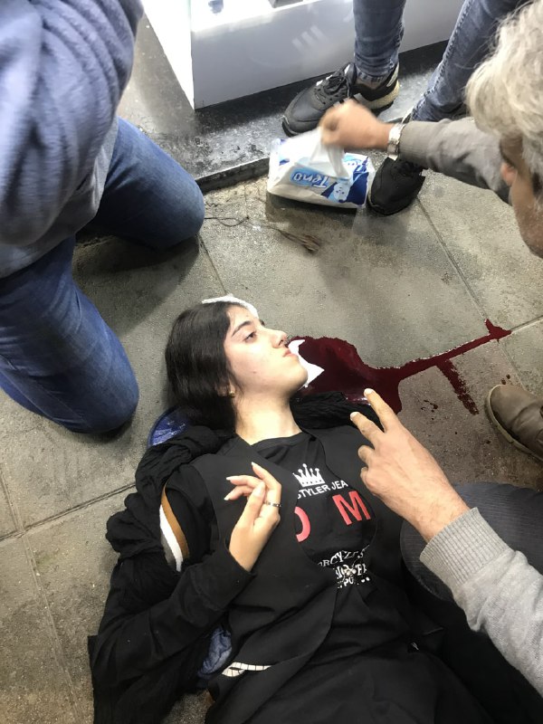 (⚠️خون در عکس دوم)منابع حامی جهوری اسلامی با انتشار  عکس اول مدعی شدند که 'فاطمه.ح، دانشجوی دانشگاه گیلان، در تجمع امروز در اثر ازدحام به زمین افتاده و از ناحیه سر دچار شکستگی مختصری شده و به بیمارستان پورسینا منتقل و پس از مداوای سرپایی مرخص شده و به منزل انتقال یافته است.'Vahidمنظورشون از ازدحام فرار مردم بیچاره از حمله‌ی مامورای بی‌شرف‌شون و تیراندازی‌شونه دیگه؟Nikita_MearsMعکس دوم نسخه واضح عکسی است که من دریافت کرده بودم و در شرحش نوشته بودند در تیراندازی امروز ماموران در #رشت به سرش تیر خورده.همون شهروند به نظر میاد.Vahidدرباره این ماجرا