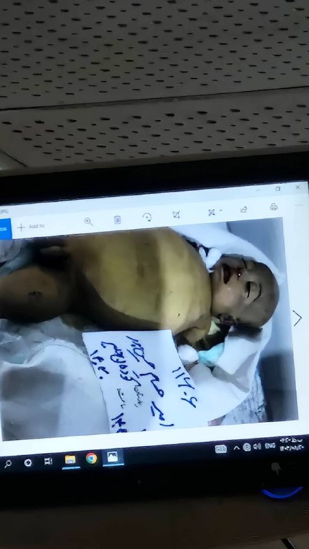 ⚠️ #نوزاد ولی بی‌جانویدیوی آخر