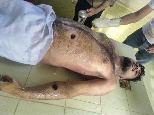 ⚠️  پیکر بی‌جان و گلوله خورده جوان ۱۹ سالهتصاویر دریافتی با شرح