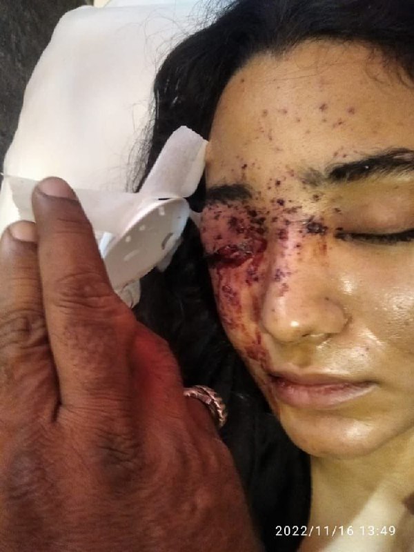 غزل رنجکش، دختر جوان اهل بندرعباس، که در اثر شلیک گلوله ساچمه‌ای به دست نیروهای حکومتی بینایی چشم راست خود را از دست داده، ماجرای زخمی شدن خود را شرح داده است. خانم رنجکش در اینستاگرام نوشته بعد از «چهار ساعت سرکلاس بودن و ۹ ساعت کار» در حال برگشت به خانه بود که هدف گلوله قرار گرفت.او افزوده «آخرین تصویری که چشم راستم ثبت کرد، لبخند اون شخص موقع شلیک کردن بود». این دختر جوان توضیح داده که برای جلوگیری از اصابت گلوله به مادرش در مقابل او ایستاد