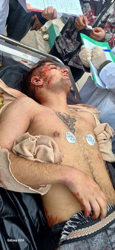 ⚠️ پیکر بی‌جان جوان ۲۲ سالهتصاویر دریافتی با شرح