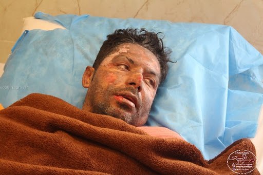 البرز فدای زاگرس شدErfanAliYabaloo#البرز_زارعی، فعال محیط زیست گچساران که چند روز پیش در حال تلاش برای مهار #آتش‌سوزی کوه دیل و نجات بلوط‌های #زاگرس در محاصره آتش بر لبه پرتگاهی گرفتار و دچار سوختگی شدید شده بود امروز در بیمارستان جان سپرد. shadimodaresمرگ #البرز_زارعی داغ ننگیست بر پیشانی مدیریت بحران در ایران. چند جوان دیگر مثل او باید به کام مرگ بروند که این سیستم مدیریت حفاظت از جنگلها تغییر کند!؟شرم آور است.AzamBahrami📡 @VahidOnlineالبرز فدای زاگرس شدErfanAliYabaloo#البرز_زارعی، فعال محیط زیست گچساران که چند روز پیش در حال تلاش برای مهار #آتش‌سوزی کوه دیل و نجات بلوط‌های #زاگرس در محاصره آتش بر لبه پرتگاهی گرفتار و دچار سوختگی شدید شده بود امروز در بیمارستان جان سپرد. shadimodaresمرگ #البرز_زارعی داغ ننگیست بر پیشانی مدیریت بحران در ایران. چند جوان دیگر مثل او باید به کام مرگ بروند که این سیستم مدیریت حفاظت از جنگلها تغییر کند!؟شرم آور است.AzamBahrami📡 @VahidOnline