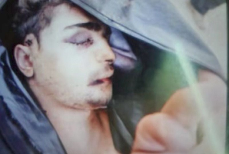 ⚠️چهره بی‌جان جوان ۱۸ سالهتصاویر دریافتی با شرح