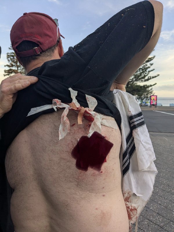 پلیس استرالیا می‌‌گوید که ۱۲ نفر در حمله‌ای در ساحل بوندای سیدنی که هدف آن جامعه یهودی بوده، کشته شده‌اند. ۲۹ نفر هم مجروح و به بیمارستان منتقل شده‌اند، از جمله یک کودک. تیراندازی همزمان با برگزاری جشنی به مناسبت حنوکای یهودیان در این ساحل رخ داد که به گفته پلیس بیش از هزار نفر در آن شرکت داشتند.رئیس‌جمهور اسرائیل این تیراندازی را حمله‌ای «بسیار بی‌رحمانه به یهودیان» توصیف کرده است.@VahidHeadlineویدیوی اول و عکس بعدش