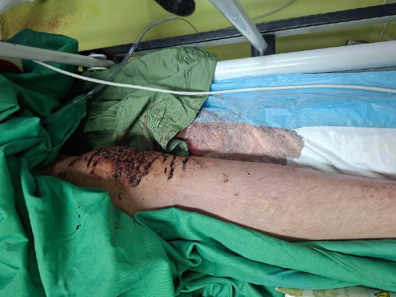 ⚠️تصاویر دلخراش و خونین دریافتی از بیمارستانی در #اصفهانتوییت انگلیسی برای ریتوییت