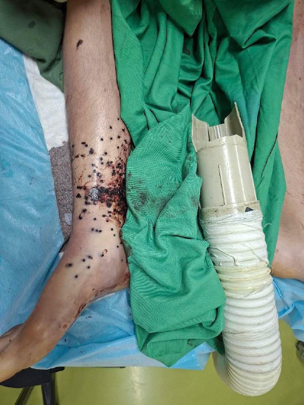 ⚠️تصاویر دلخراش و خونین دریافتی از بیمارستانی در #اصفهانتوییت انگلیسی برای ریتوییت