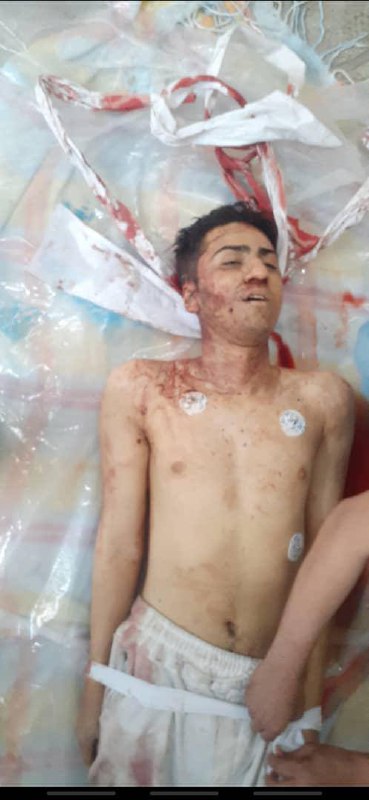 ⚠️ پیکر بی‌جان یک جوان ۱۸ سالهتصاویر دریافتی با شرح