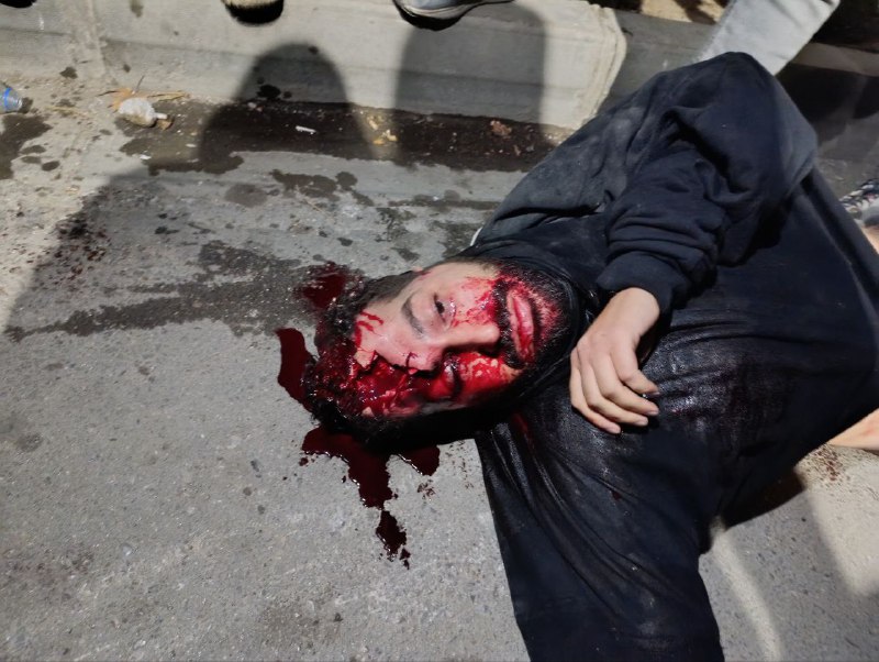 ⚠️خونین و دلخراش