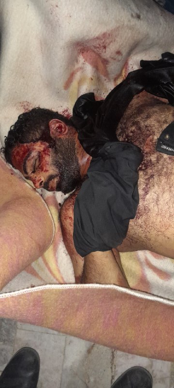 ⚠️ پیکر بی‌جان جوان ۲۹ سالهتصاویر دریافتی با شرح