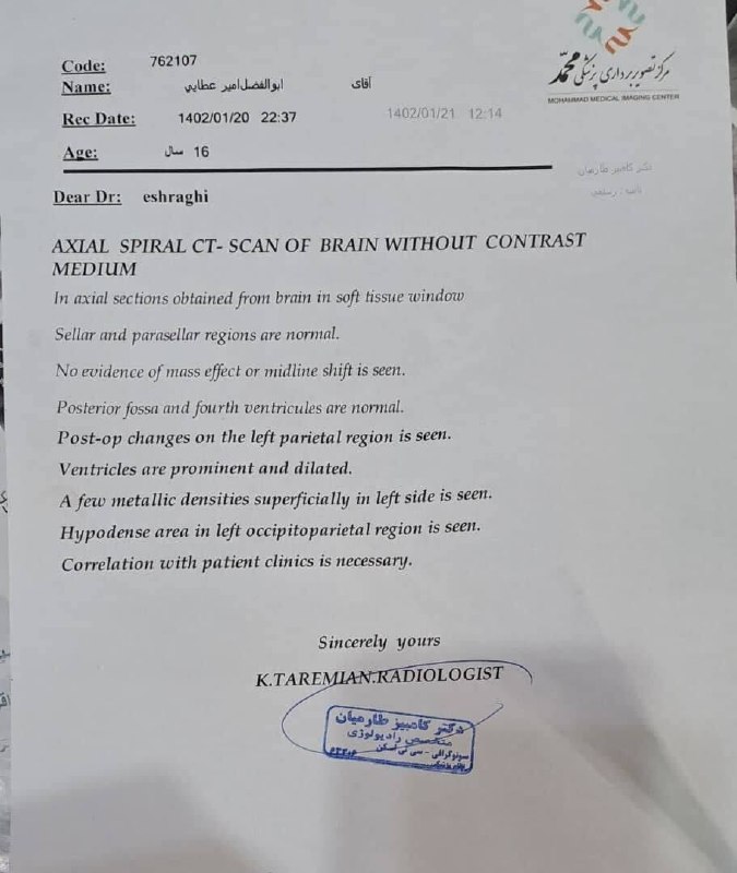 ابوالفضل امیرعطایی فقط ۱۶ سال دارد. در ۳۰ شهریور ۱۴۰۱ در شهرری یک نیروی حکومتی گاز اشک‌آور را از روبه‌رو از فاصله یک متری به سر ابوالفضل شلیک می‌کند.جمجمه سمت چپ کامل ترکیده و یک سری رگ‌های عصبی‌اش تخلیه شده. او در حال حاضر فلج است و فقط چشمانش حرکت می‌کند.این بچه نیاز به یک جراح مغز دارد. کمک کنیم ابوالفضل ۱۶ ساله دوباره حرکت کند. via SalomeSeyednia#ابوالفضل_امیرعطایی📡 @VahidOnlineابوالفضل امیرعطایی فقط ۱۶ سال دارد. در ۳۰ شهریور ۱۴۰۱ در شهرری یک نیروی حکومتی گاز اشک‌آور را از روبه‌رو از فاصله یک متری به سر ابوالفضل شلیک می‌کند.جمجمه سمت چپ کامل ترکیده و یک سری رگ‌های عصبی‌اش تخلیه شده. او در حال حاضر فلج است و فقط چشمانش حرکت می‌کند.این بچه نیاز به یک جراح مغز دارد. کمک کنیم ابوالفضل ۱۶ ساله دوباره حرکت کند. via SalomeSeyednia#ابوالفضل_امیرعطایی📡 @VahidOnline