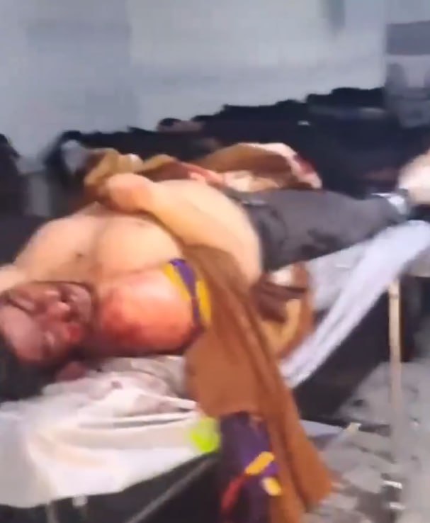 ⚠️ پیکر بی‌جان جوان ۲۲ ساله‌ای که #درفش_کاویانی داشت.تصاویر دریافتی با شرح