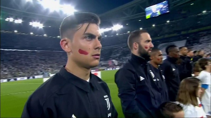 بازیکنان #یوونتوس و #ناپولی علیه #خشونت_علیه_زنان امشب با این رد رژ لب روی گونه‌های‌شان وارد زمین شده و بازی می‌کنند. madyar