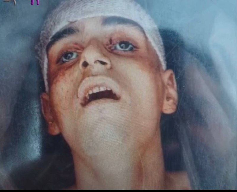 ⚠️ چهره بی‌جان نوجوان ۱۷ سالهتصاویر دریافتی با شرح