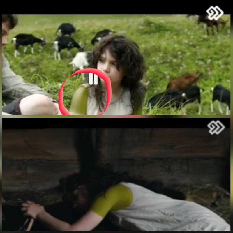 بازوی دختربچه بازیگر فیلم 