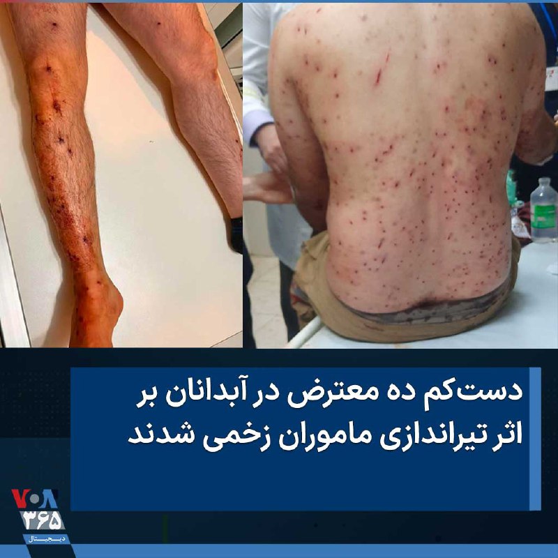 VOA Farsi صدای آمریکا (@VOAfarsi) on X