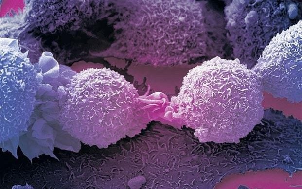 Immune cell that kills most cancers discovered by accident by British scientists&nbsp;